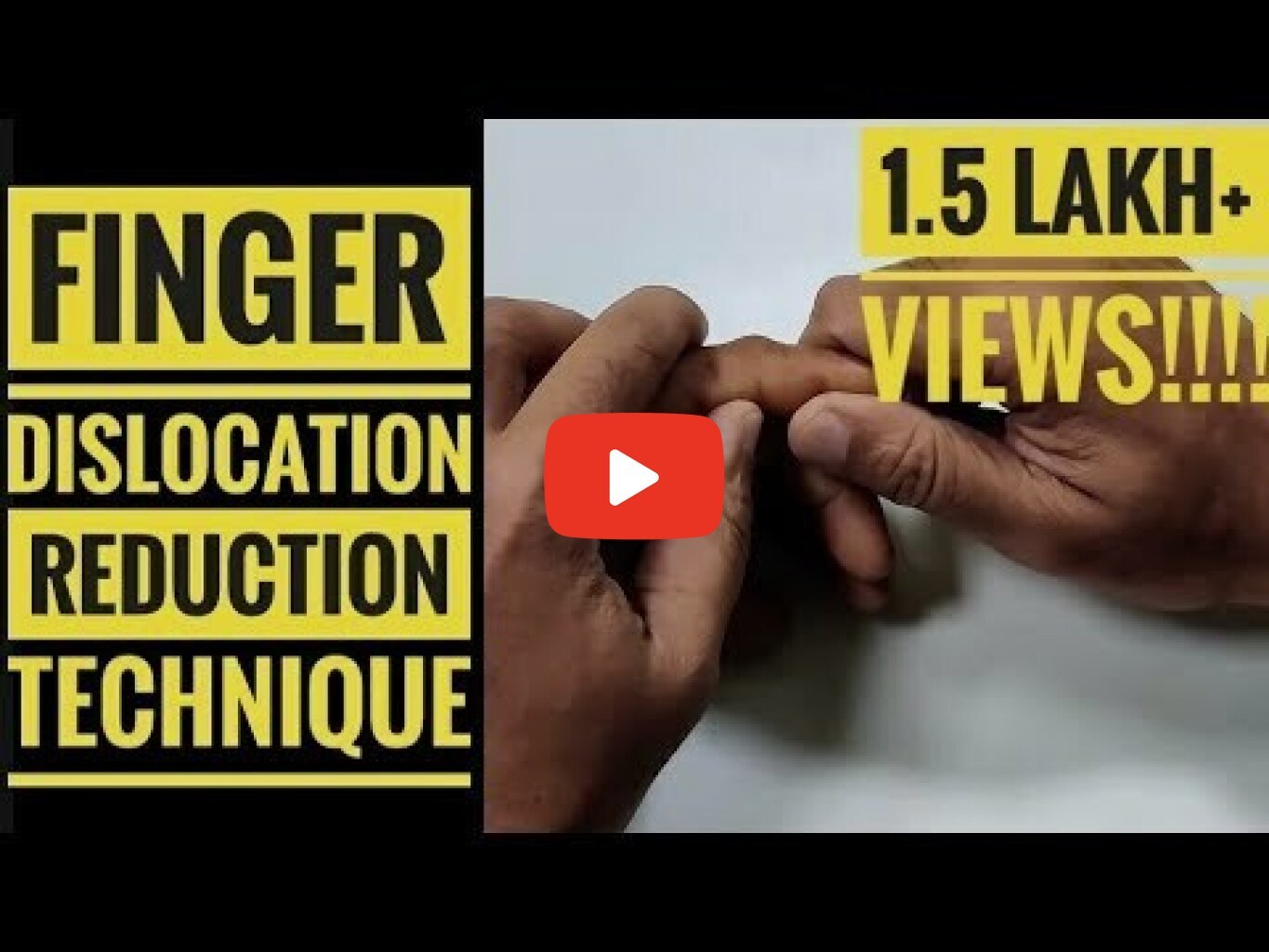 Finger Dislocation Reduction Technique