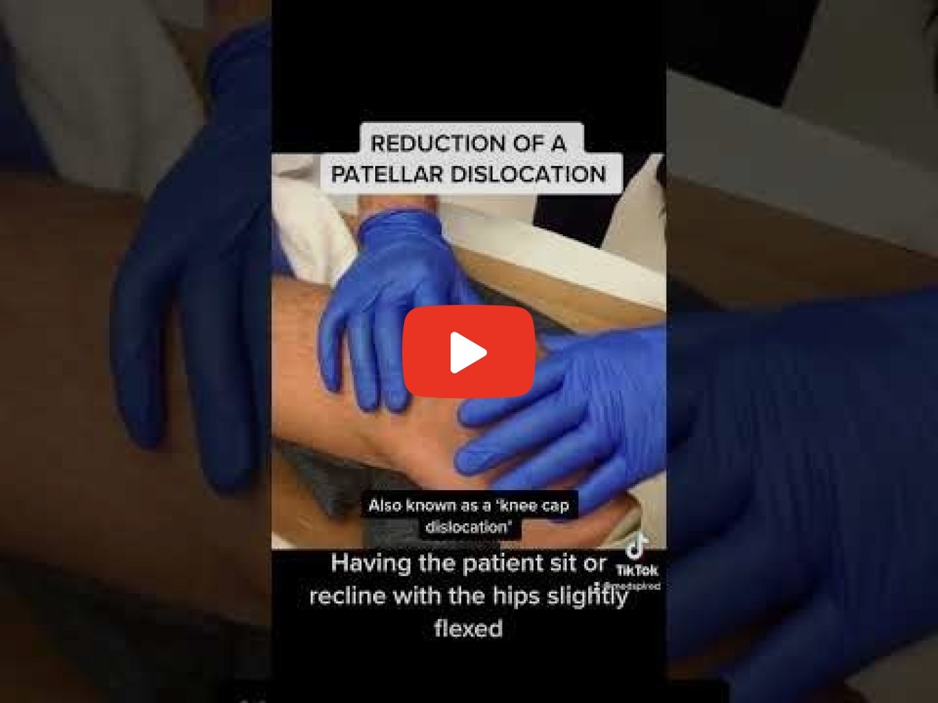 Reduction of a Patellar Dislocation